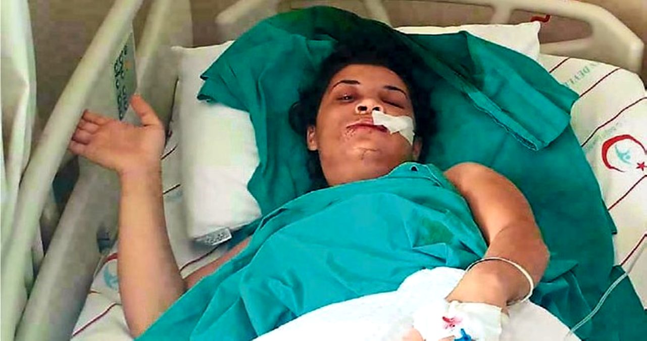 Eski kocası tarafından şiddet gören kadın: Emine gibi ölmek istemiyorum, devlet bizi korusun