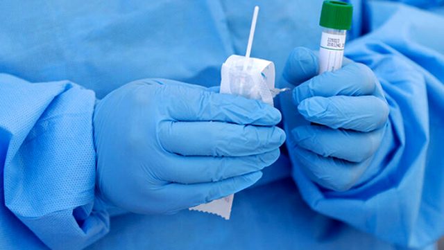 Fırsatçılar bedeva olan koronavirüs testlerini 1.250 TL’ye yapıyor