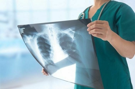 Amgen’dan Akciğer Kanseri Farkındalık Günü’ne özel ‘Bir Nefeste’ kampanyası