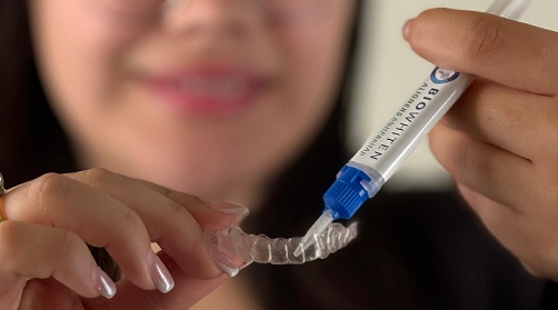 Şeffaf Plak Tedavisinde Renklenme ve Beyaz Nokta Lezyonlarına Karşı Biyolojik Çözüm