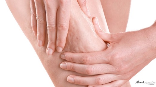 “Selülit Sadece Selülit Değildir; Metabolik Bir Aynadır”